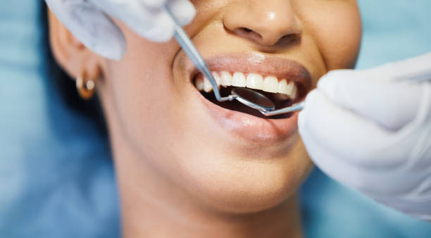 Best Emergency Wisdom Teeth Removal in Trafford, PA