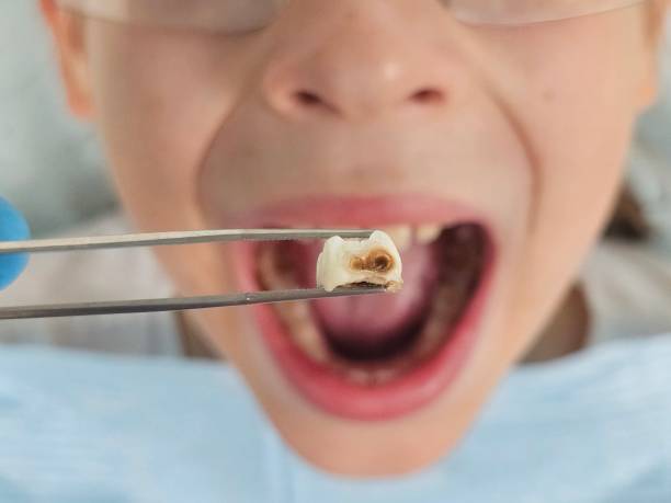 Best Pediatric Emergency Dentist in Trafford, PA